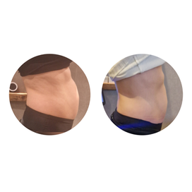 Resultaat van EMS-training bij de taille